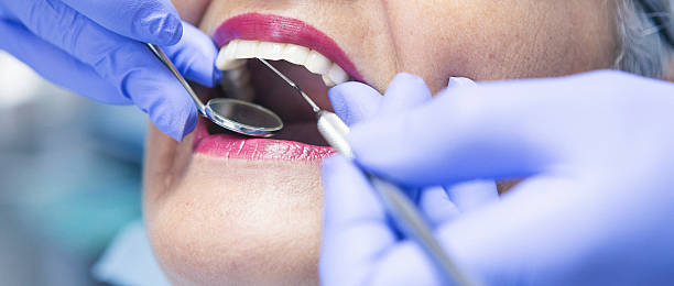 Best Emergency Dental Extractions in Lake Park, GA